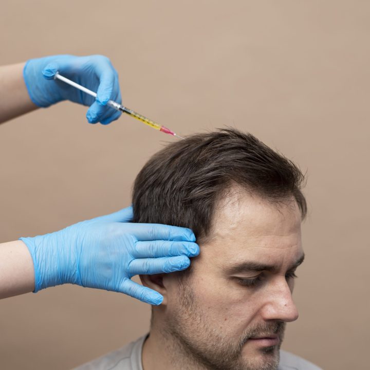 man-getting-prp-injection-alopecia man-getting-prp-injection-alopecia